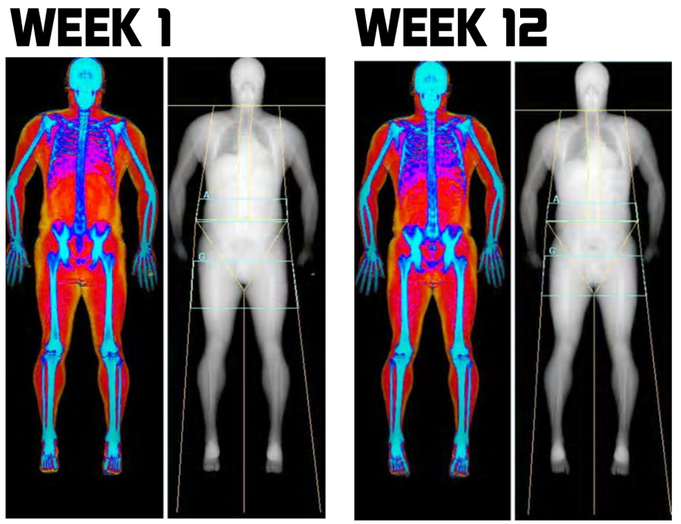 DXA - Body Composition and 6 Reasons Why You Might Want One